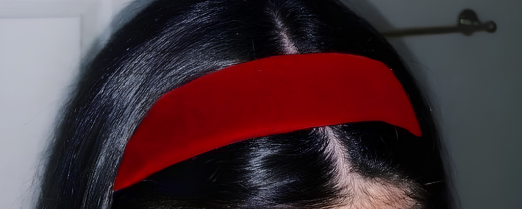 overcoming-patchy-hair-loss